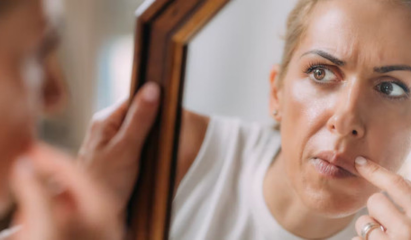 Do You Have Body Dysmorphic Disorder? What is BDD?